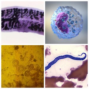 Parasites and protozoa