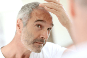 Hair growth in men